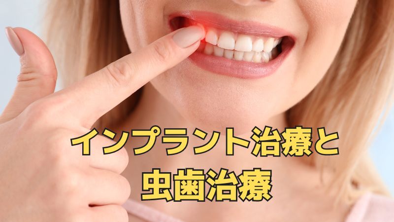香川県高松市のインプラント治療ができる歯医者をお探しなら、吉本歯科医院へ。骨が薄い方、骨がないと言われた方のインプラント
