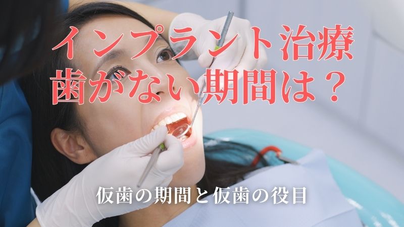インプラント治療中の歯がない期間｜仮歯について｜高松市のインプラント治療なら吉本歯科医院