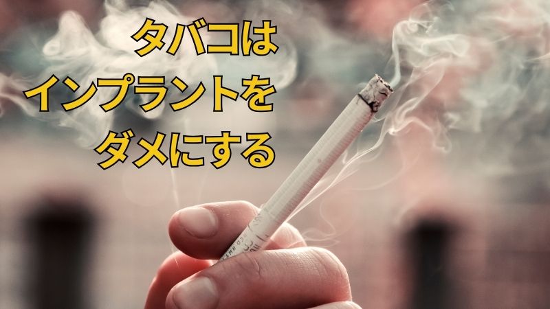 タバコを吸っている人のインプラントリスク｜高松市の吉本歯科医院
