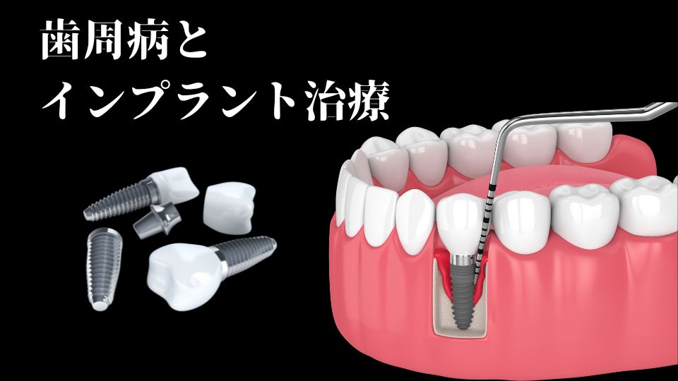 歯周病をなおさずにインプラント治療をする危険性|高松市の吉本歯科医院