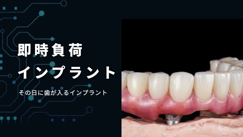 手術したその日に歯がはいる即時負荷インプラントなら香川県 高松市の吉本歯科医院