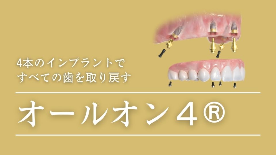 重度歯周病から1日で歯が入るオールオン４なら高松市の吉本歯科医院